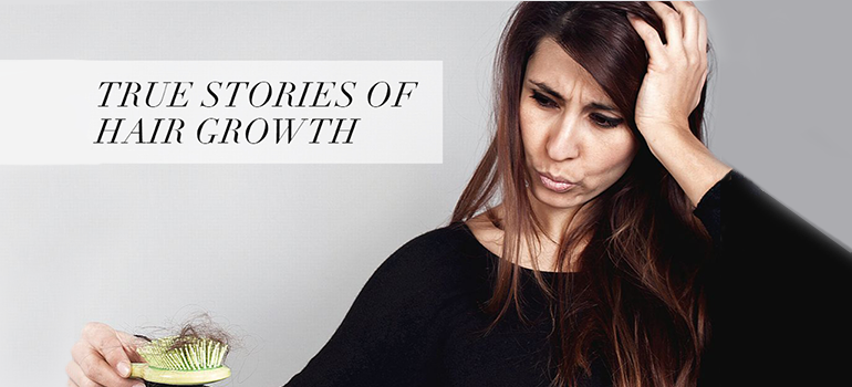 True Stories of Hair Growth