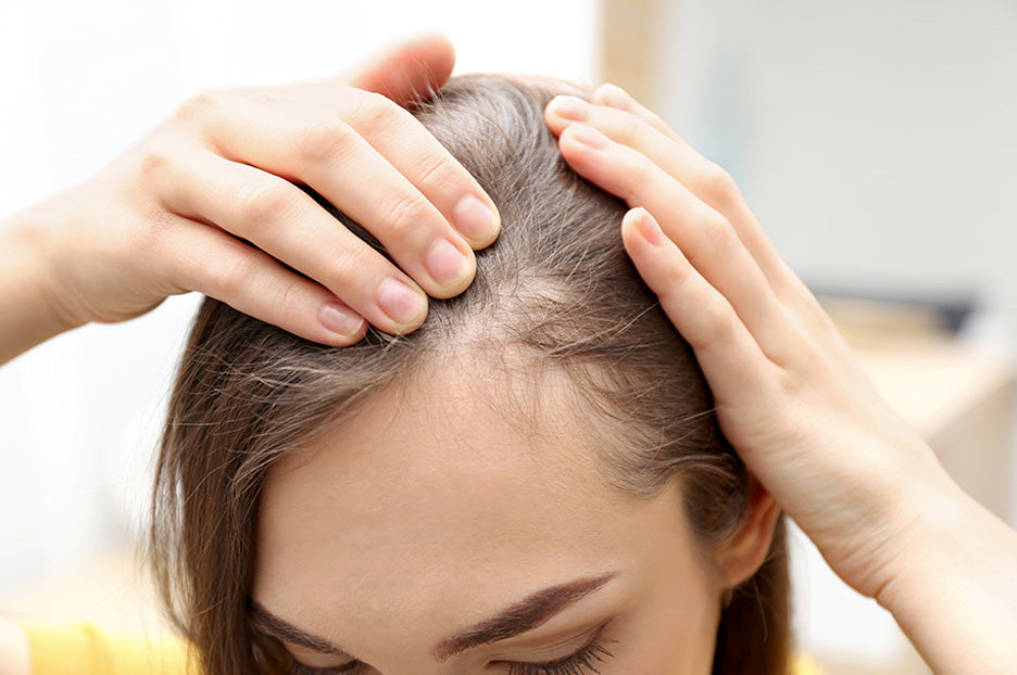 Postpartum Hair Loss: Prevention Tips & Best Remedies