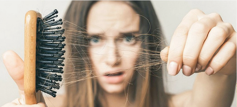 10 Facts About Women’s Hair Loss