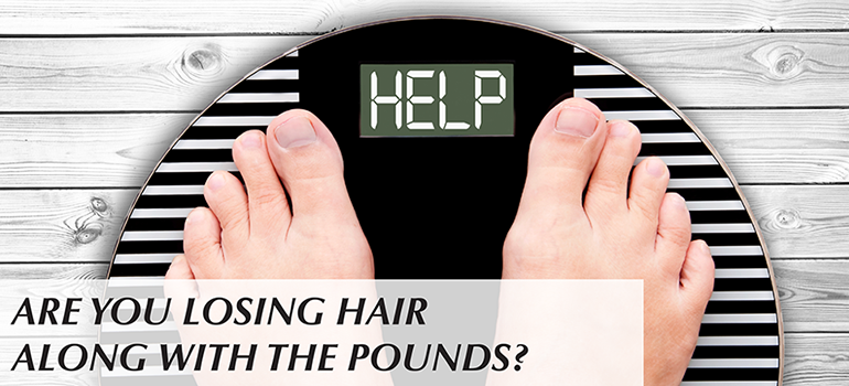 Shedding the Weight Could Also Mean Shedding Your Hair