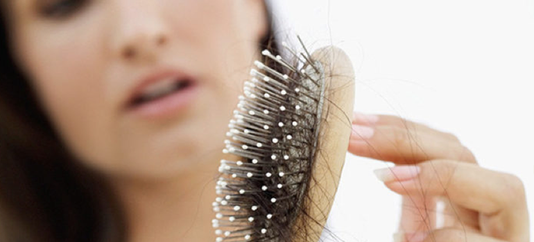 3 Causes of Hair Loss in Women