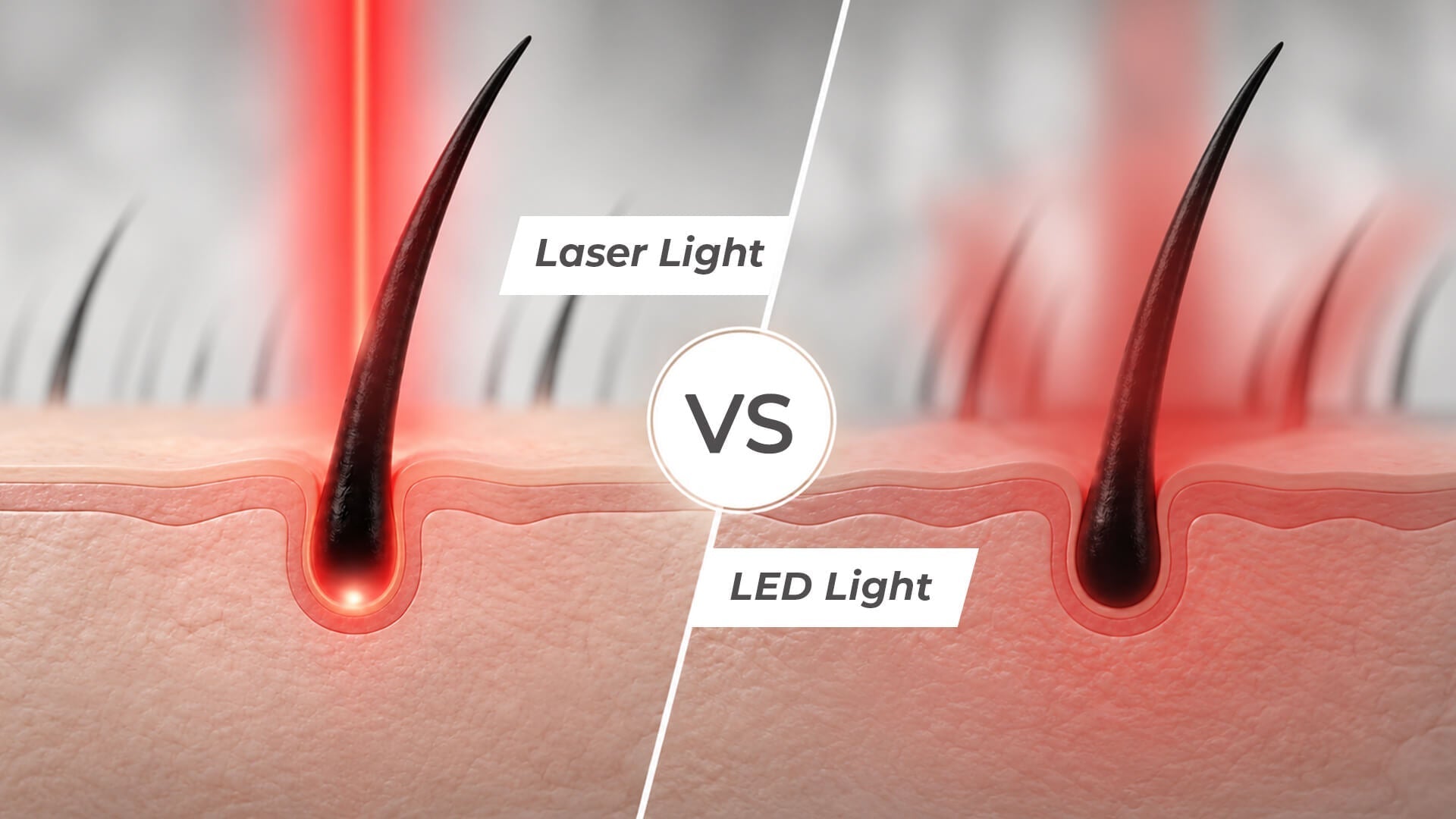 Laser vs LED Hair Growth: Understanding the Difference Between Laser and LED Hair Growth Technology