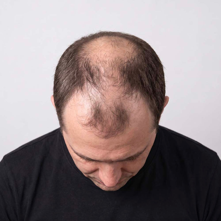 Male hair growth process