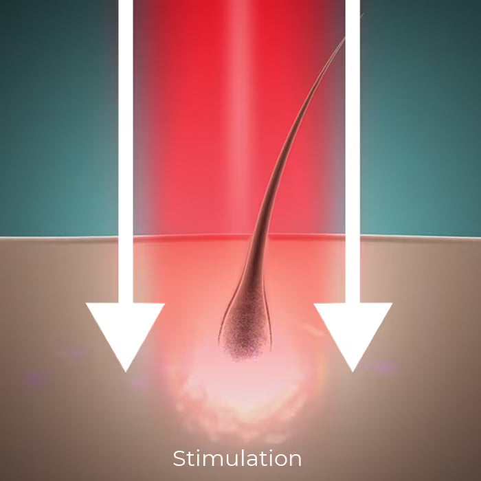 Hairmax - Laser Intensity Focused Laser Light Reaches Follicles