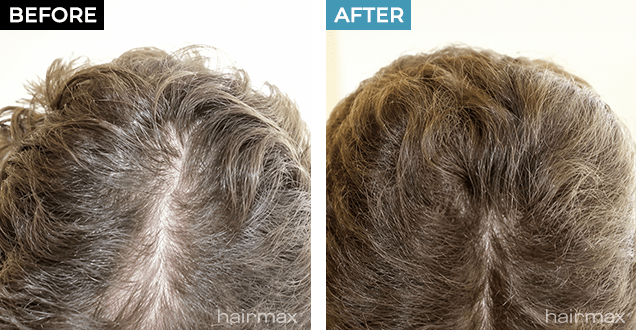 Before and After Results