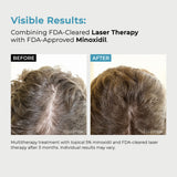 Men’s Extra Strength 5% Minoxidil