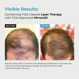 Men’s Extra Strength 5% Minoxidil