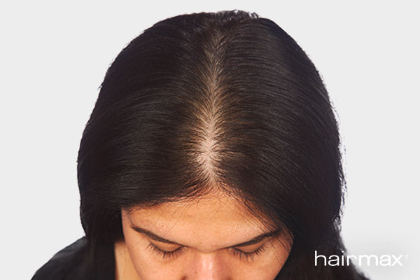 After 6 months treatment