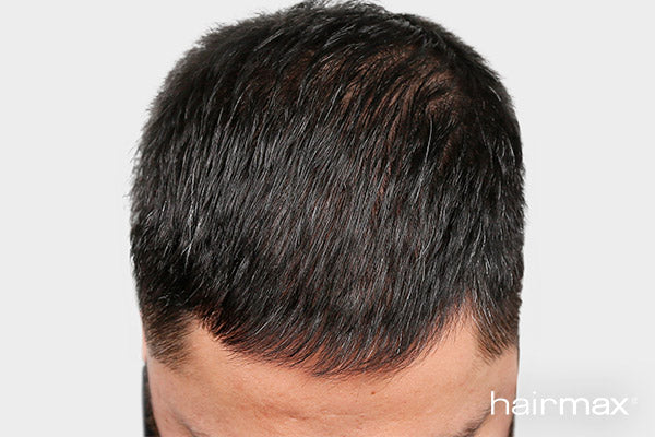 After 6 months treatment