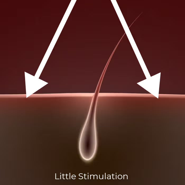 iRestore Essential - Diffused Light-Less Energy Reaches Follicles